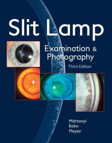 Slit Lamp: Examination and Photography by Csaba L. Martonyi CRA FOPS