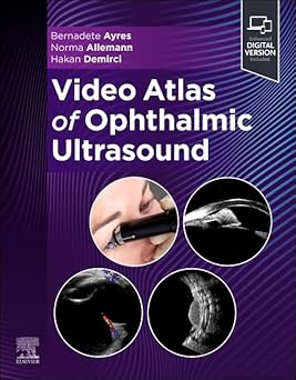 Video Atlas of Ophthalmic Ultrasound (just  Pdf)