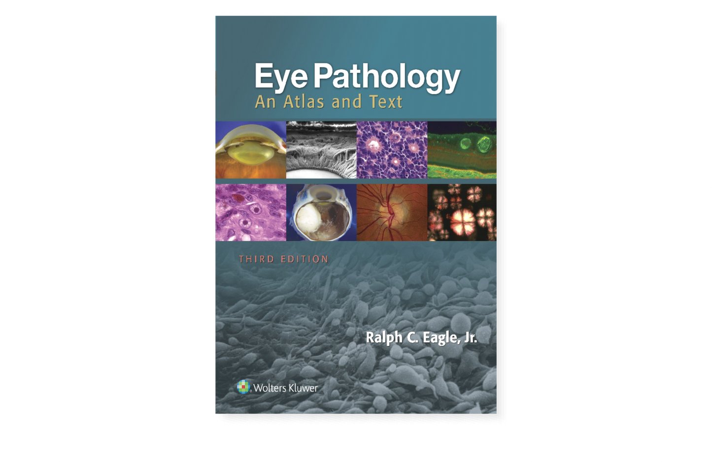 Eye Pathology An Atlas and Text