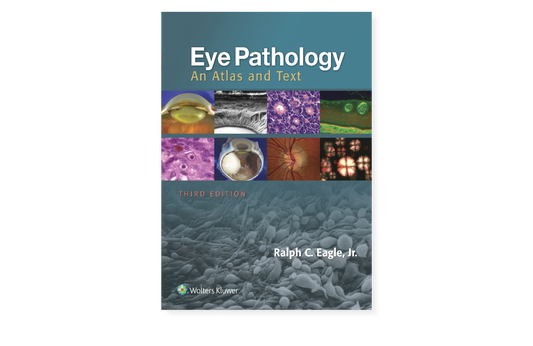 Eye Pathology An Atlas and Text